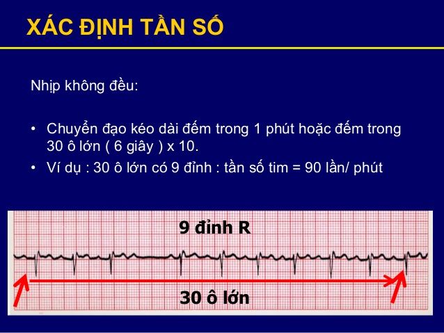 Tần số là gì