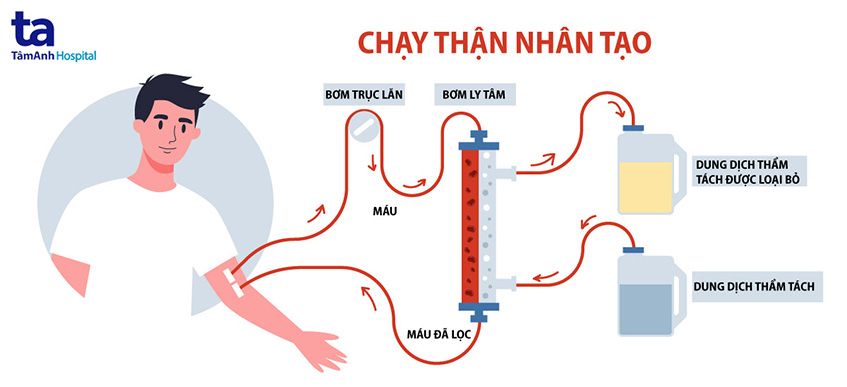 quy trình chạy thận nhân tạo