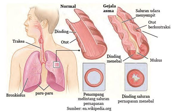 Bagian paru-paru yang secara fungsional melaksanakan fungsi pertukaran gas adalah