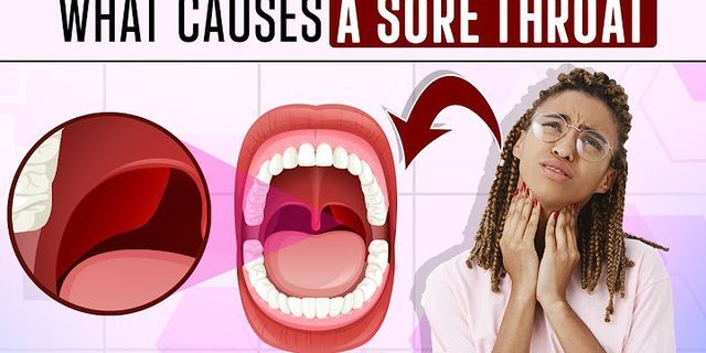 A sore throat là gì
