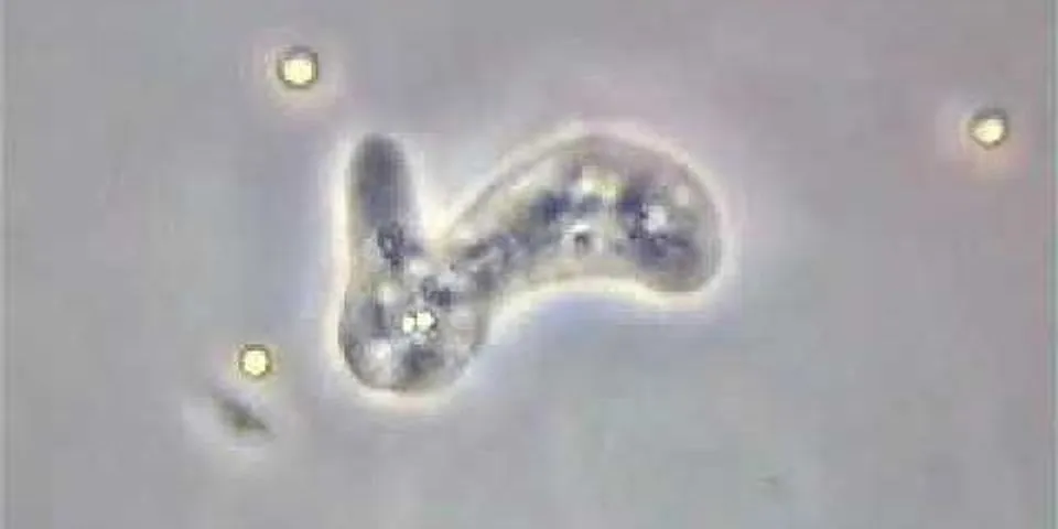 Amoeba merupakan protozoa yang bergerak dengan menggunakan …. *