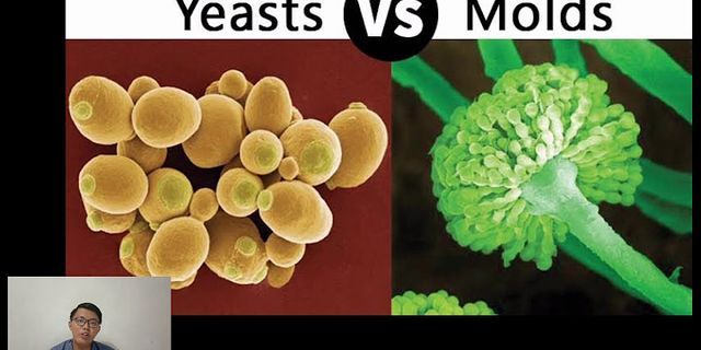 Apa perbedaan bakteri gram positif dengan?