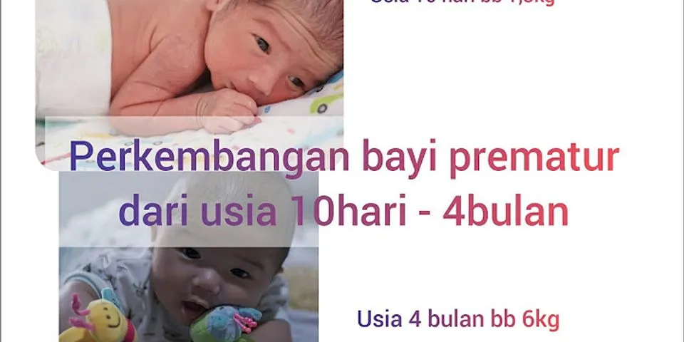 Apa yang dimaksud bayi prematur