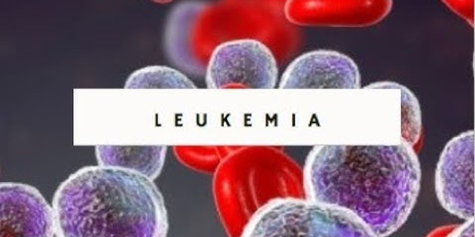 Maksud leukemia MicroRNA
