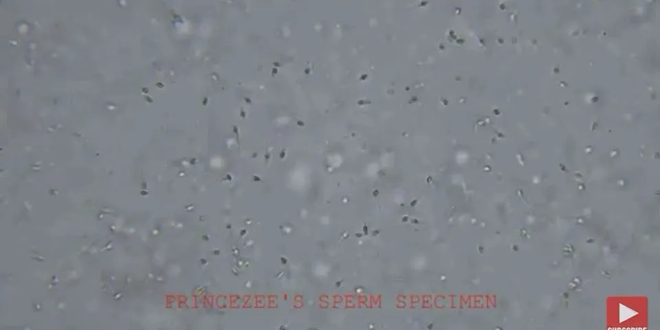 B bagian apa dari sperma yang mampu menembus lapisan sel telur?