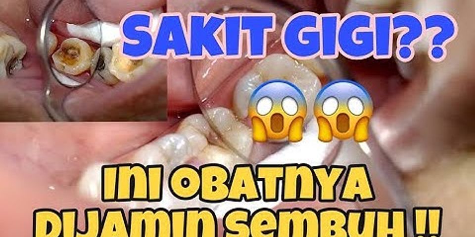 Berapa lama reaksi obat sakit gigi