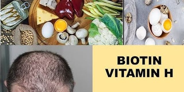 Biotin vitamin H giá bao nhiêu