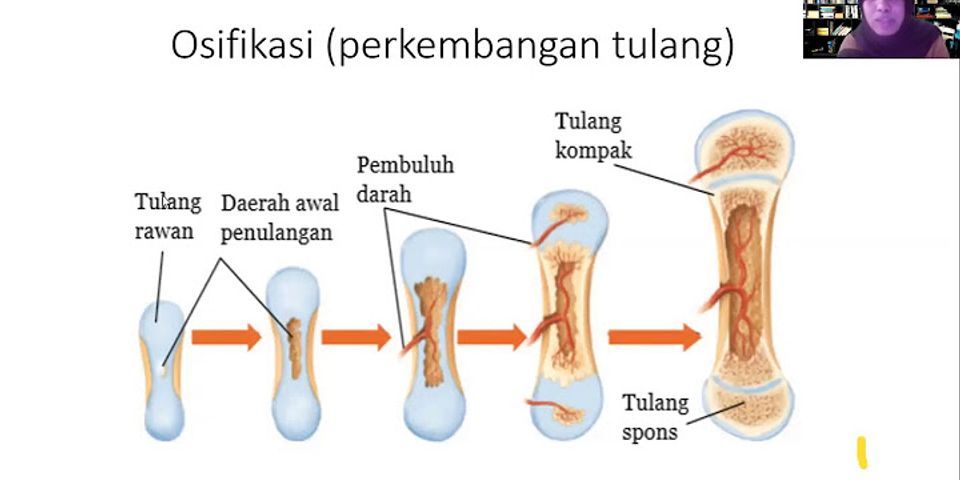 Tulang tengkorak merupakan tulang yang memiliki bentuk