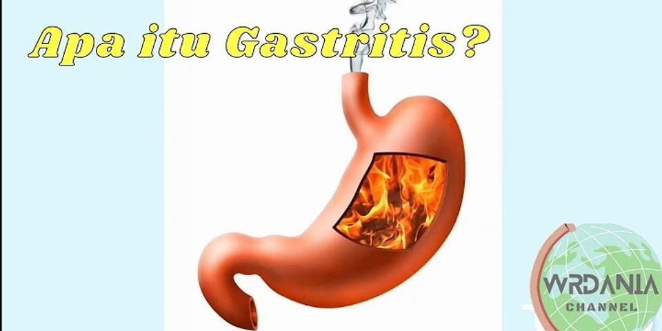 Cual es el mejor probiótico para la gastritis