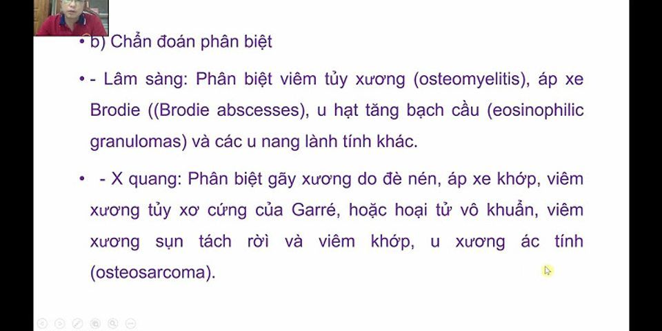 Hãy dẫn câu thơ Làn thu thủy nét xuân sơn theo cách dẫn giận tiếp