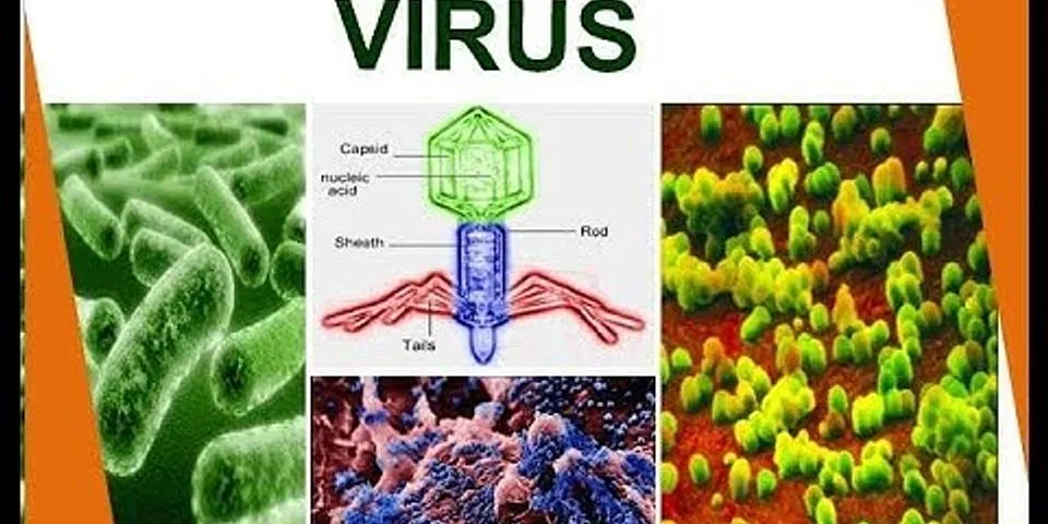 Jelaskan sifat-sifat virus sebagai makhluk hidup dan makhluk tidak hidup