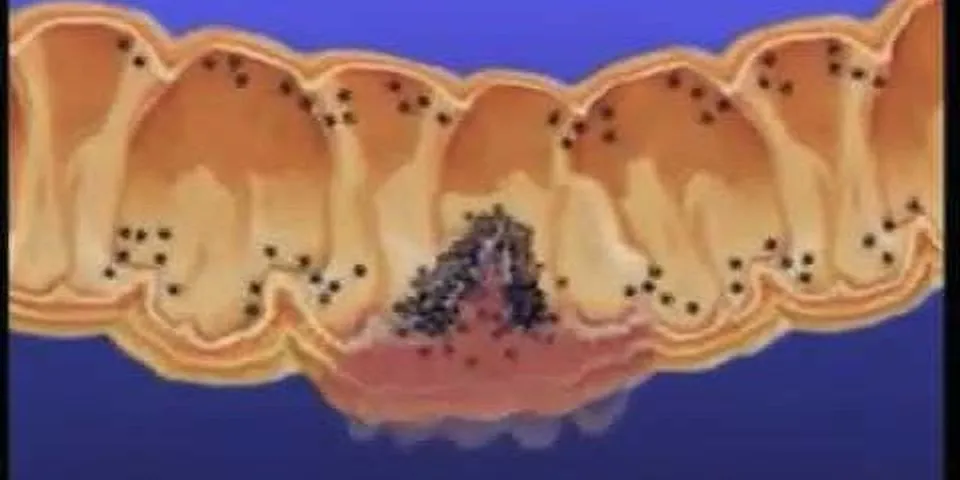 Jenis bakteri yang terdapat di dalam usus besar adalah