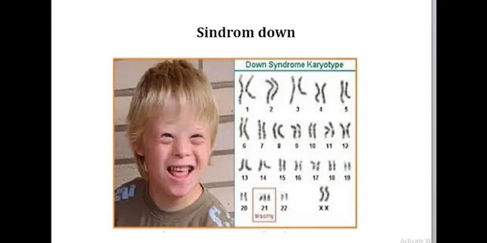 Kelainan jumlah kromosom yang hanya terjadi pada pasangan kromosom tertentu disebut