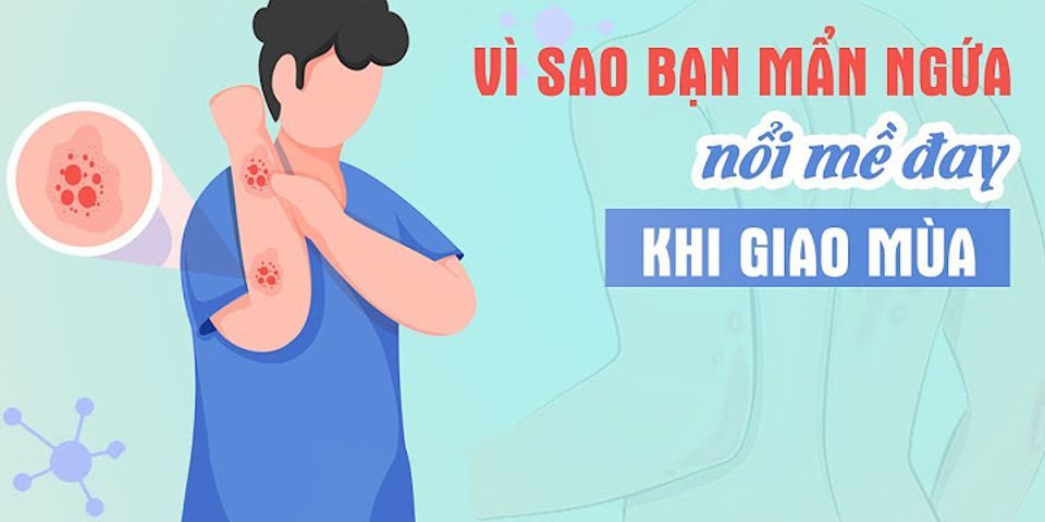 Nổi mề đay bao lâu mới hết