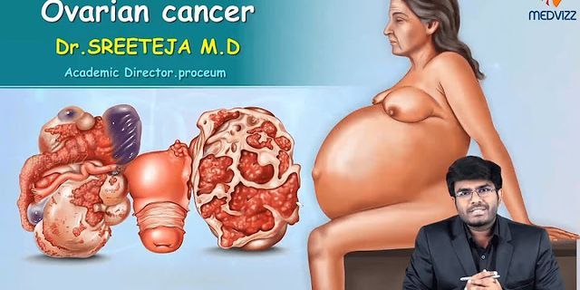 Ovarian cancer là gì