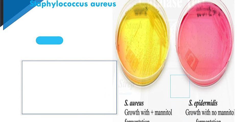 Phương pháp xác định Staphylococcus aureus trong thực phẩm