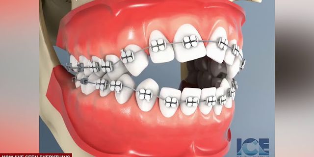 Răng miền Trung nghĩa là gì