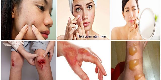Tại sao chúng ta nên thường xuyên bảo vệ và rèn luyện da
