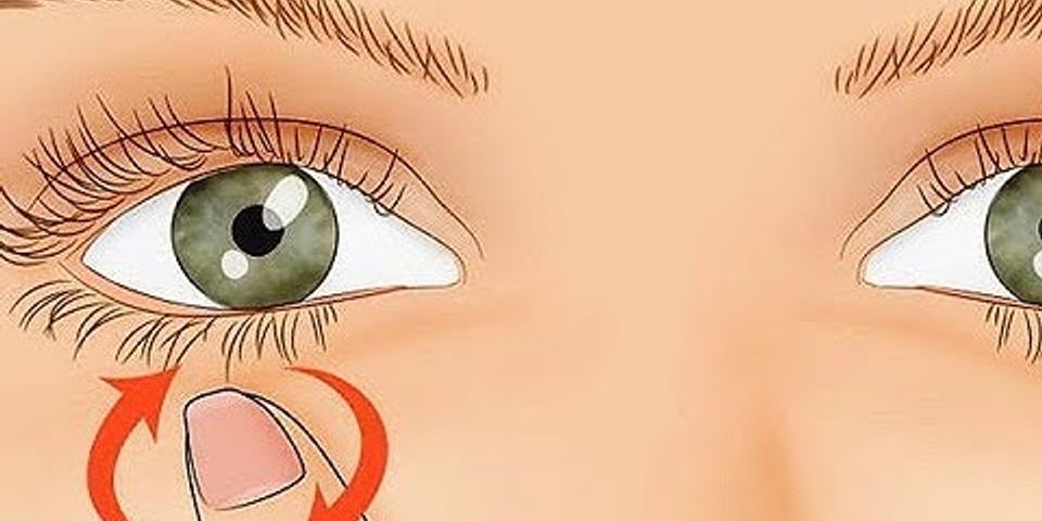 Tại sao mí mắt trái bị giật liên tục