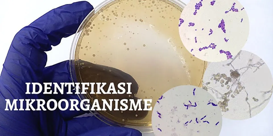 Tindakan yang dapat dilakukan untuk menghilangkan mikroorganisme yang berbahaya