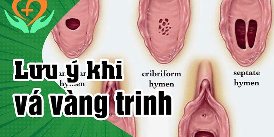 Xem màng trinh nằm ở đâu