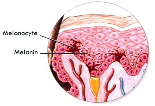 Vì sao vùng kín bị thâm đen?