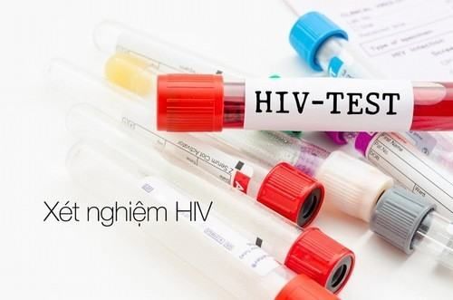 Xét nghiệm HIV bao lâu thì có kết quả